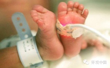 BBC：患病婴儿让中国穷人左右为难