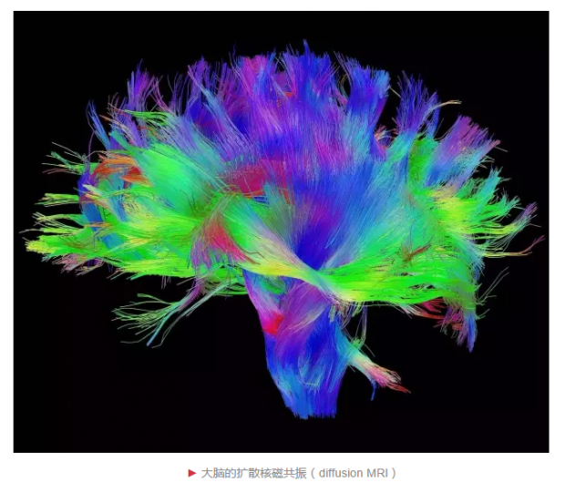 看见神经：从卡哈尔到现代神经解剖学