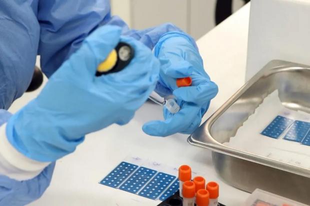 国药新冠疫苗在秘鲁的试验结果将于2021年3-4月公布