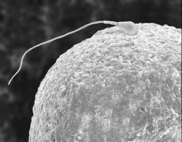 试管婴儿并不生于试管——胚胎何时起成为“人”？